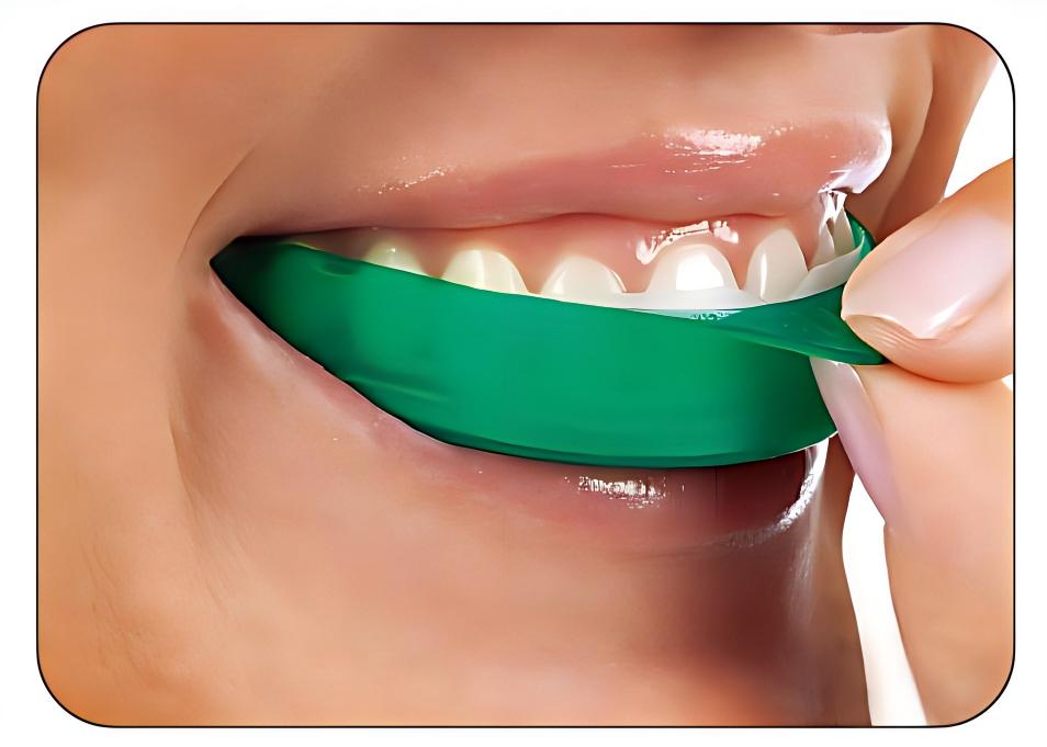 Teeth Whitening Opalescence Go - Ultradent Opalescence Go Diş Beyazlatma Bantları