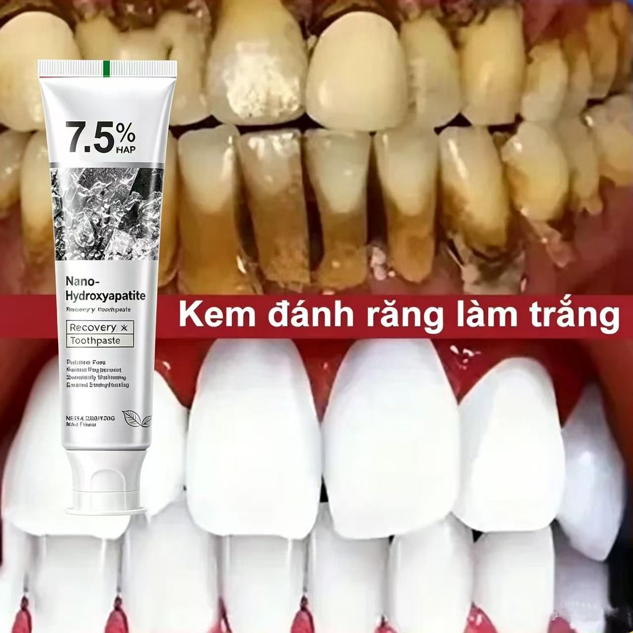 Teeth Whitening That Works - %7,5 Hidroksiapatit Probiyotik Beyazlatıcı Diş Macunu