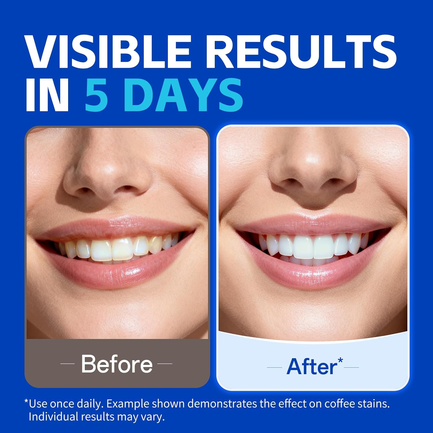 7 çift Diş Beyazlatma Şeritler - Teeth Whitening Strips Permanent incelemesi ve fiyatı