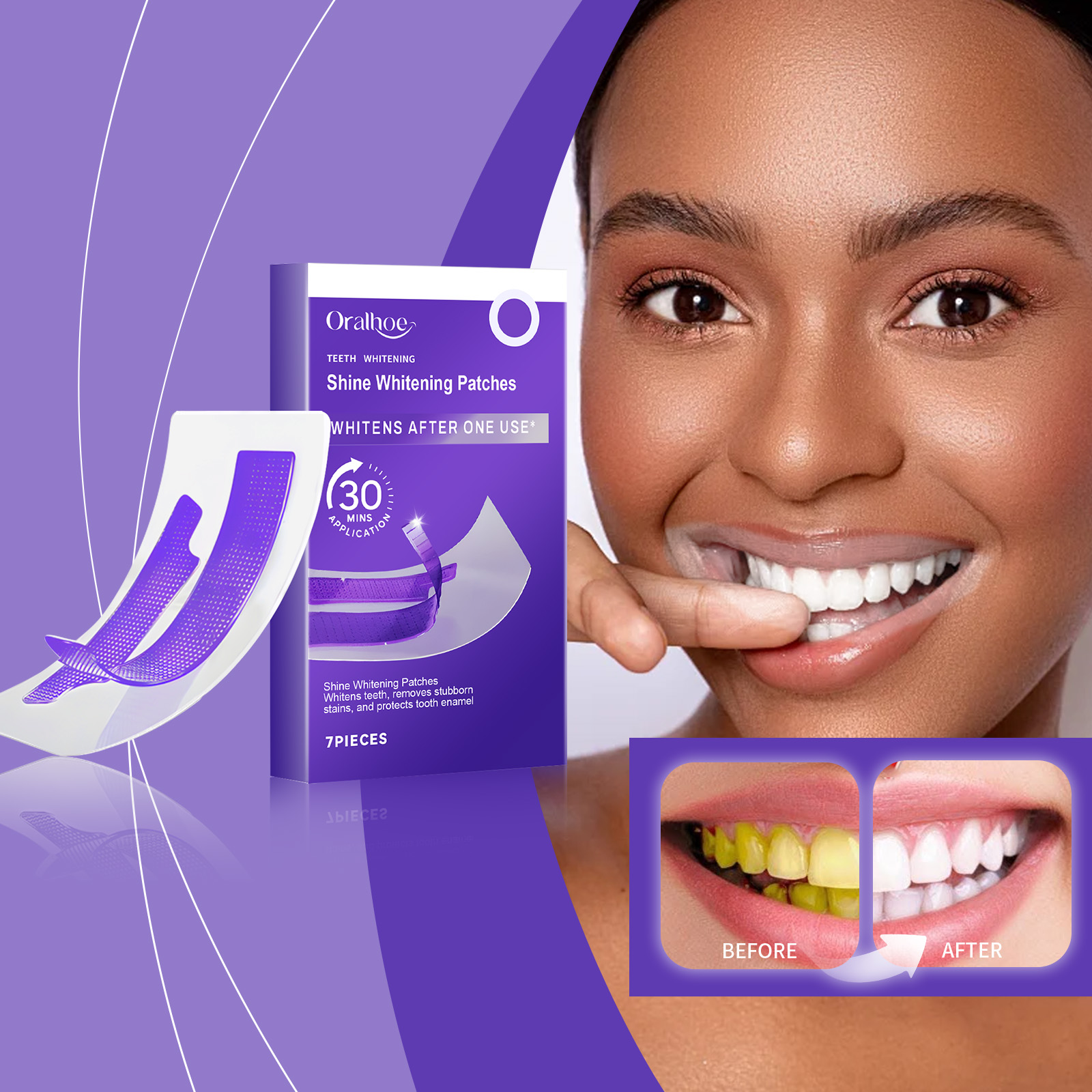 Mor Diş Beyazlatma Şeritleri – - Teeth Whitening Strips Permanent incelemesi ve fiyatı