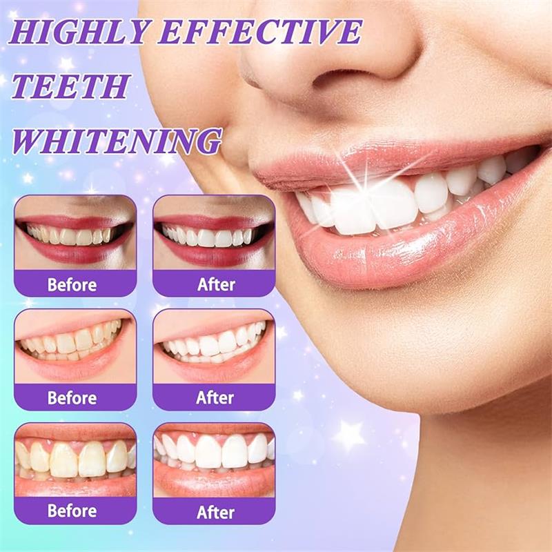 9D Mor Diş Beyazlatıcı Diş Mac - Teeth Whitening That Works incelemesi ve fiyatı