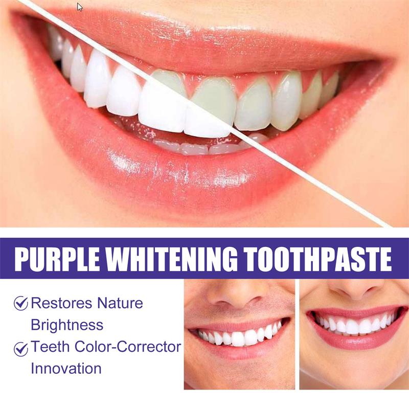 9D Mor Diş Beyazlatıcı Diş Mac - Teeth Whitening That Works incelemesi ve fiyatı