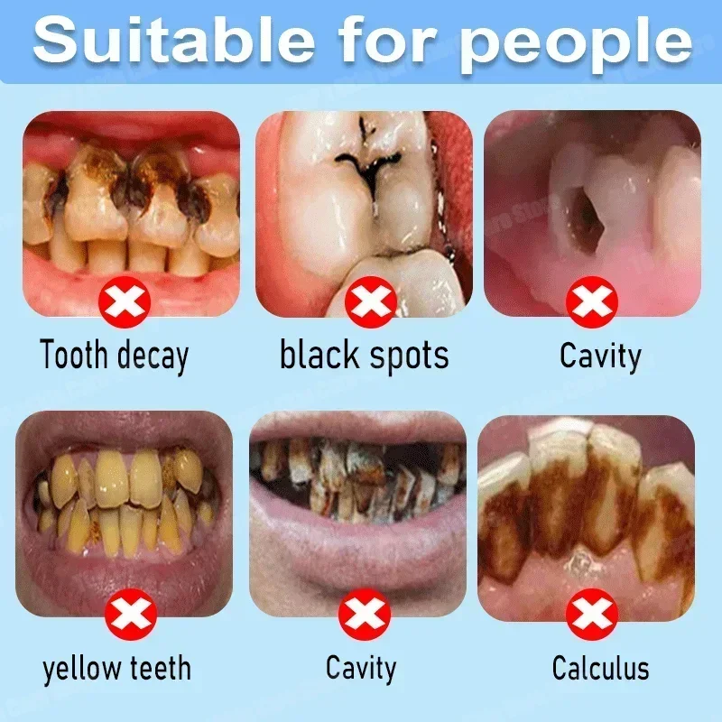 Çürük Önleyici Diş Macunu Çürü - Teeth Whitening That Works incelemesi ve fiyatı