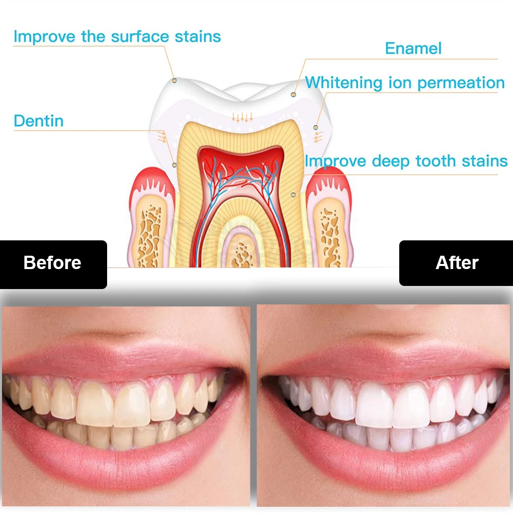 Diş Diş Beyazlatma Kiti Mini 1 - Teeth Whitening That Works incelemesi ve fiyatı