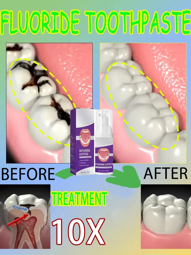Sıcak satışlar En çok satan, B - Teeth Whitening That Works incelemesi ve fiyatı