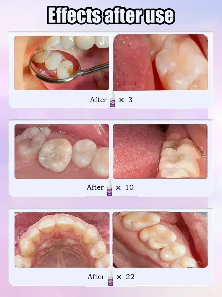 Diş Temizleme Diş Macunu Diş L - Teeth Whitening That Works incelemesi ve fiyatı
