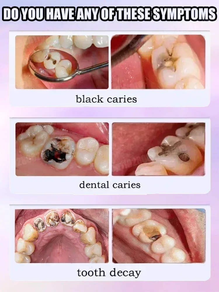 Diş Temizleme Diş Macunu Diş L - Teeth Whitening That Works incelemesi ve fiyatı
